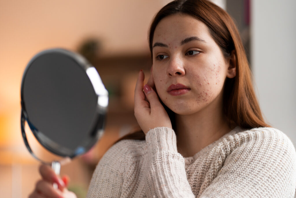 How to Remove Pigmentation from Face Permanently at Home